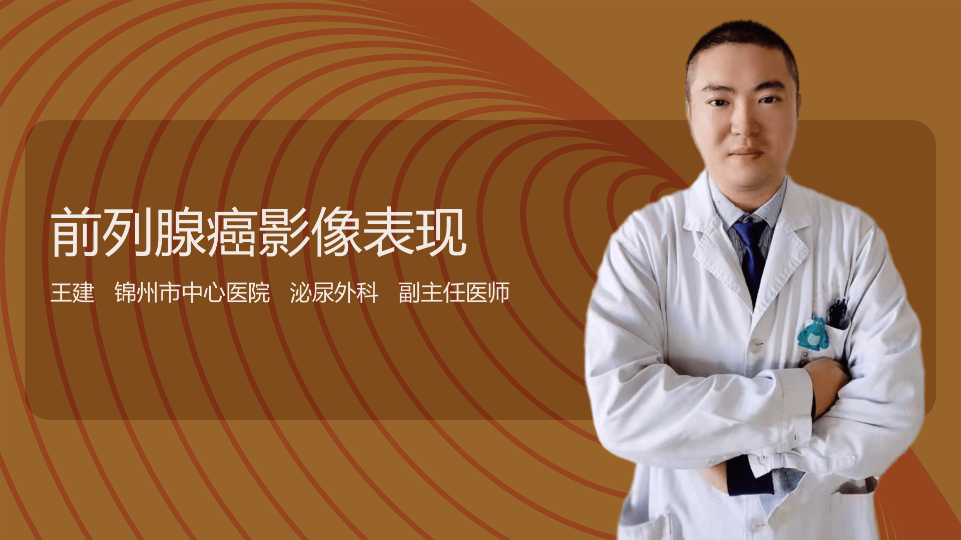 前列腺癌影像表现